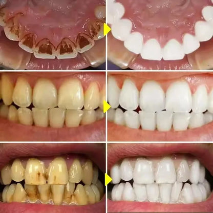 Teeth Whitening Toothpaste for Coffee Stains