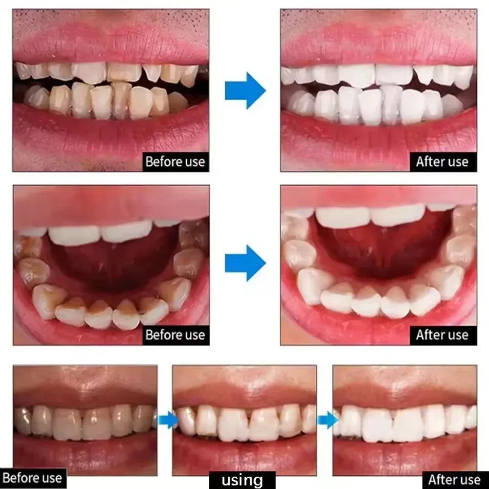 Teeth Whitening Toothpaste for Coffee Stains